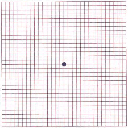 Amsler Grid Test | Pittsburgh Eye Institute